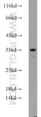 Protein Activator Of Interferon Induced Protein Kinase EIF2AK2 antibody, 10771-1-AP, Proteintech Group, Western Blot image 