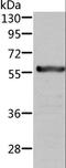 Aldehyde Dehydrogenase 6 Family Member A1 antibody, LS-C401217, Lifespan Biosciences, Western Blot image 