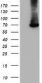 EPM2A Interacting Protein 1 antibody, M12427-2, Boster Biological Technology, Western Blot image 