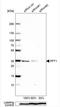 Palmitoyl-Protein Thioesterase 1 antibody, NBP1-85563, Novus Biologicals, Western Blot image 