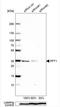 Palmitoyl-protein thioesterase 1 antibody, NBP1-85563, Novus Biologicals, Western Blot image 