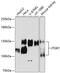 Integrin Subunit Beta 1 antibody, 13-899, ProSci, Western Blot image 