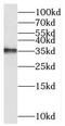 Chromosome 2 Open Reading Frame 49 antibody, FNab01098, FineTest, Western Blot image 