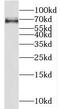 Regulator Of G Protein Signaling 7 antibody, FNab07273, FineTest, Western Blot image 