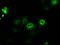Cytochrome P450 Oxidoreductase antibody, TA500611, Origene, Immunofluorescence image 