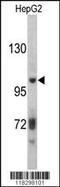 Inter-Alpha-Trypsin Inhibitor Heavy Chain 2 antibody, 62-419, ProSci, Western Blot image 