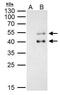 PBX Homeobox 1 antibody, GTX113242, GeneTex, Immunoprecipitation image 