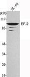 Eukaryotic Translation Elongation Factor 2 antibody, STJ98488, St John