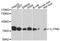 Interleukin 17 Receptor B antibody, abx136057, Abbexa, Western Blot image 