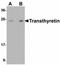 Transthyretin antibody, LS-B7812, Lifespan Biosciences, Western Blot image 