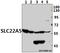 Solute Carrier Family 22 Member 5 antibody, A01527, Boster Biological Technology, Western Blot image 