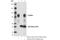 Forkhead Box O3 antibody, 99199S, Cell Signaling Technology, Immunoprecipitation image 