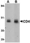 HCLS1-associated protein X-1 antibody, orb75868, Biorbyt, Western Blot image 