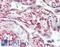 Placental Growth Factor antibody, LS-B15663, Lifespan Biosciences, Immunohistochemistry paraffin image 