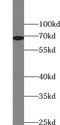 Unc-5 Family C-Terminal Like antibody, FNab09262, FineTest, Western Blot image 
