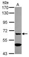 Alpha-1,3-Mannosyl-Glycoprotein 4-Beta-N-Acetylglucosaminyltransferase A antibody, NBP2-17285, Novus Biologicals, Western Blot image 