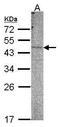 Phosphatidylinositol 4-Kinase Type 2 Beta antibody, GTX107908, GeneTex, Western Blot image 