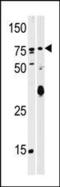 SCY1-like protein 2 antibody, PA5-13751, Invitrogen Antibodies, Western Blot image 