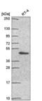Proteasome 26S Subunit, Non-ATPase 11 antibody, NBP2-55793, Novus Biologicals, Western Blot image 