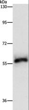 HCK Proto-Oncogene, Src Family Tyrosine Kinase antibody, LS-C404038, Lifespan Biosciences, Western Blot image 
