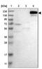 Solute Carrier Family 12 Member 1 antibody, NBP1-82559, Novus Biologicals, Western Blot image 