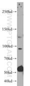 Valosin Containing Protein Interacting Protein 1 antibody, 17802-1-AP, Proteintech Group, Western Blot image 