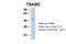 TraB Domain Containing antibody, PA5-42217, Invitrogen Antibodies, Western Blot image 