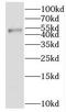 IKAROS Family Zinc Finger 1 antibody, FNab04204, FineTest, Western Blot image 