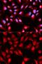 DEAD-Box Helicase 5 antibody, GTX54031, GeneTex, Immunofluorescence image 