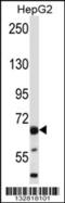 Phosphatase And Actin Regulator 2 antibody, 56-904, ProSci, Western Blot image 