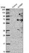 Acrosin Binding Protein antibody, PA5-58649, Invitrogen Antibodies, Western Blot image 