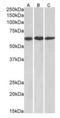 Matrix Metallopeptidase 14 antibody, orb107657, Biorbyt, Western Blot image 
