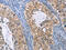 Interferon Regulatory Factor 3 antibody, CSB-PA283183, Cusabio, Immunohistochemistry paraffin image 