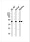 Major Histocompatibility Complex, Class I, B antibody, LS-C164912, Lifespan Biosciences, Western Blot image 