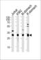 Esterase D antibody, PA5-49328, Invitrogen Antibodies, Western Blot image 