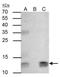 Beta-2-Microglobulin antibody, NBP2-15566, Novus Biologicals, Immunoprecipitation image 