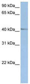 Nuclear receptor subfamily 2 group E member 1 antibody, TA338238, Origene, Western Blot image 