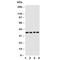 CD1d Molecule antibody, R30948, NSJ Bioreagents, Western Blot image 