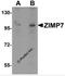 Zinc finger MIZ domain-containing protein 2 antibody, 6235, ProSci, Western Blot image 