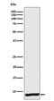 Apolipoprotein C1 antibody, M02526, Boster Biological Technology, Western Blot image 