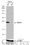 Peroxiredoxin 3 antibody, GTX112004, GeneTex, Western Blot image 