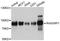 RASGRP1 antibody, A10495, ABclonal Technology, Western Blot image 