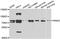Interleukin 1 Receptor Associated Kinase 2 antibody, AHP2481, Bio-Rad (formerly AbD Serotec) , Western Blot image 
