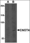 CCR4-NOT Transcription Complex Subunit 4 antibody, orb89192, Biorbyt, Western Blot image 