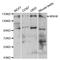 MutS Homolog 6 antibody, A0983, ABclonal Technology, Western Blot image 