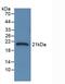 Serpin Family A Member 6 antibody, abx132060, Abbexa, Western Blot image 