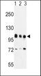 Enhancer Of Zeste 2 Polycomb Repressive Complex 2 Subunit antibody, PA5-24594, Invitrogen Antibodies, Western Blot image 