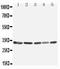 TNF Alpha Induced Protein 8 Like 3 antibody, LS-C313352, Lifespan Biosciences, Western Blot image 