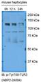 Toll Like Receptor 3 antibody, NBP2-24904, Novus Biologicals, Western Blot image 