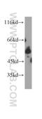 LCK Proto-Oncogene, Src Family Tyrosine Kinase antibody, 60162-1-Ig, Proteintech Group, Western Blot image 